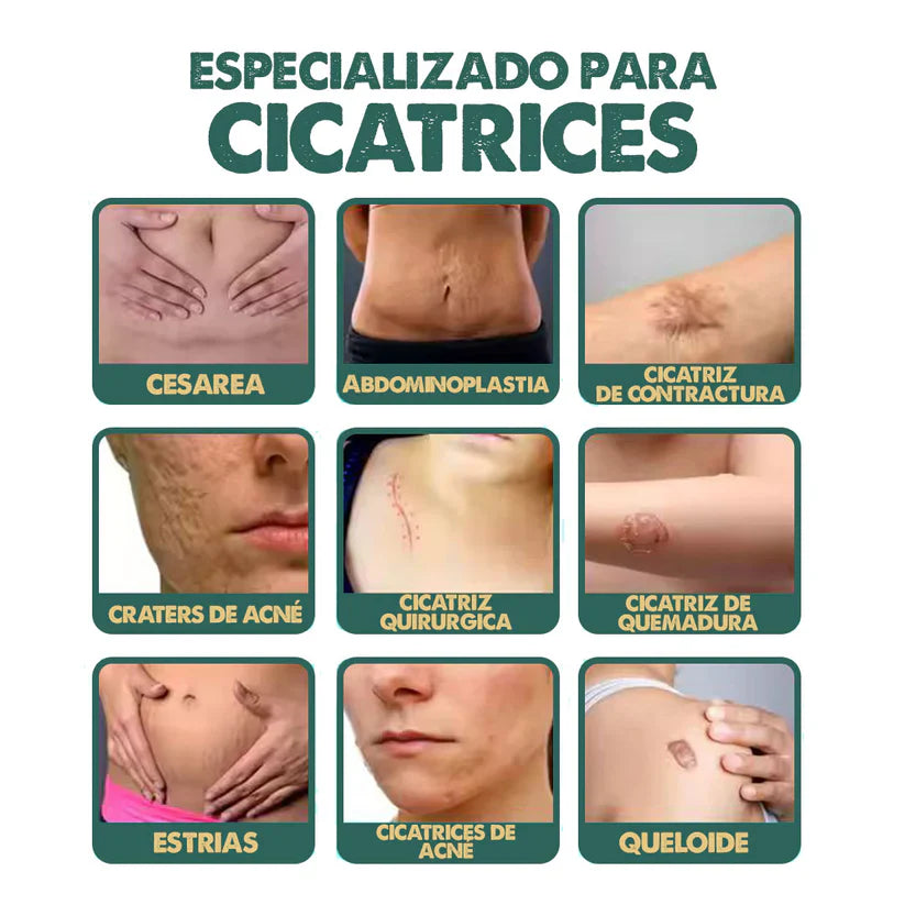 Spray Elimina Cicatrices - South Moon