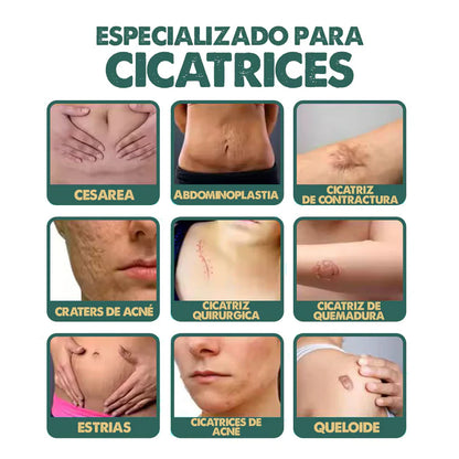 Spray Elimina Cicatrices - South Moon